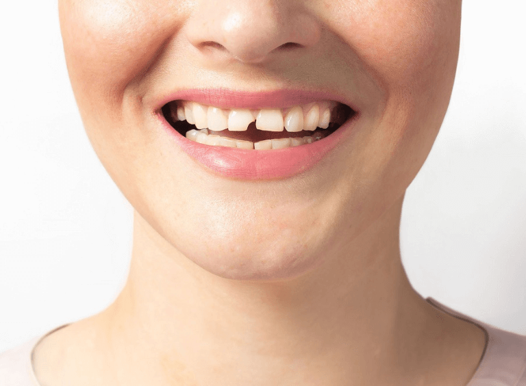 Woman with broken tooth visiting her dentist in bolton at Harwood dental practice