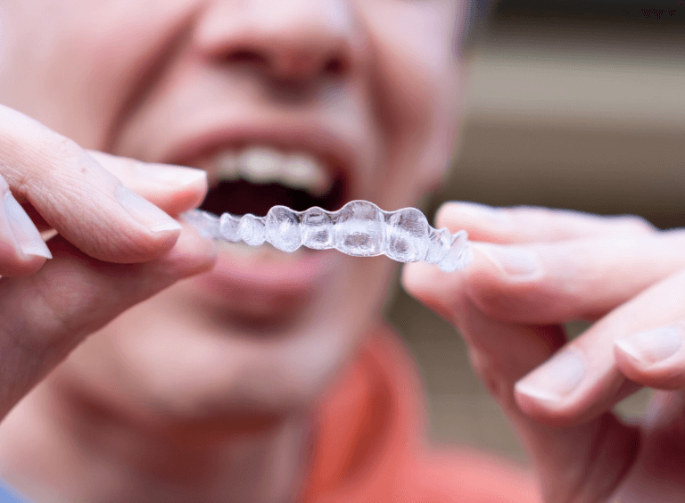 Man with invisalign braces at Harwood Dental Practice