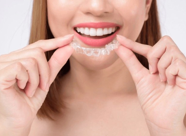 Woman with invisalign braces at her dentist in bolton