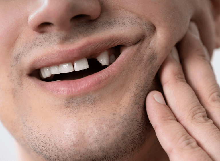 Man with loose tooth at Harwood dental practice