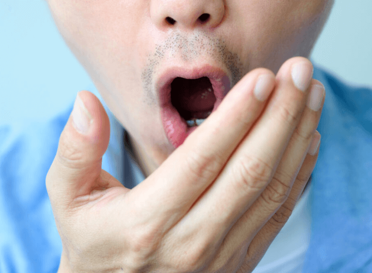 man with bad breath before visiting his dentist in Bolton