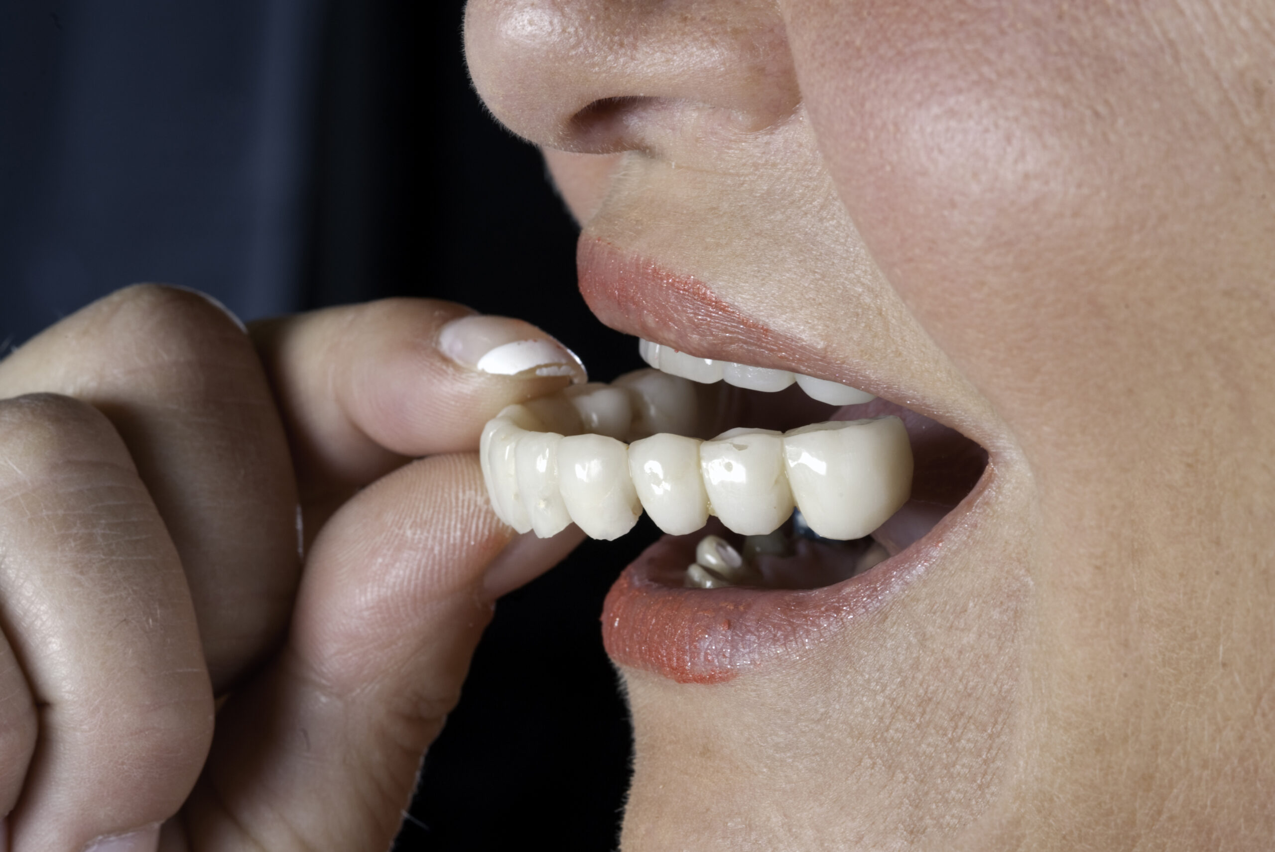 Woman putting in her dentures